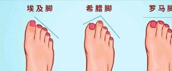 困扰！教你挑选百搭实用的鞋子AG旗舰厅入口选择鞋子告别(图5)